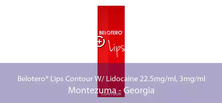 Belotero® Lips Contour W/ Lidocaine 22.5mg/ml, 3mg/ml Montezuma - Georgia