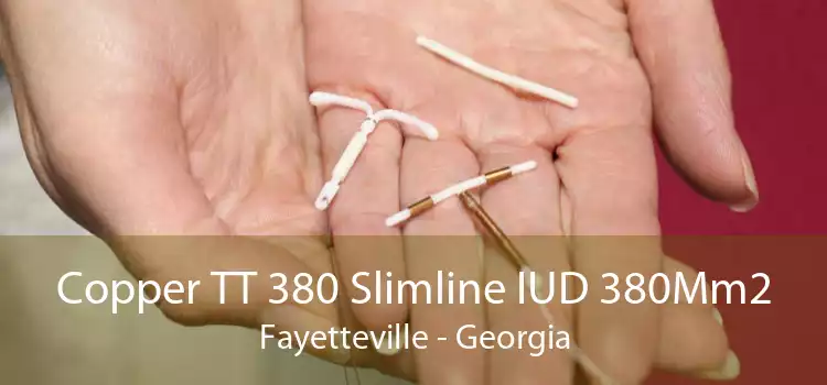 Copper TT 380 Slimline IUD 380Mm2 Fayetteville - Georgia