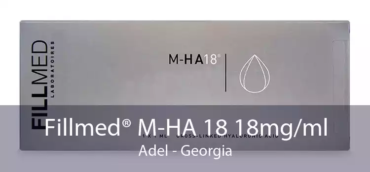 Fillmed® M-HA 18 18mg/ml Adel - Georgia