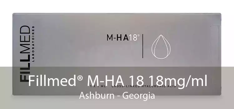 Fillmed® M-HA 18 18mg/ml Ashburn - Georgia