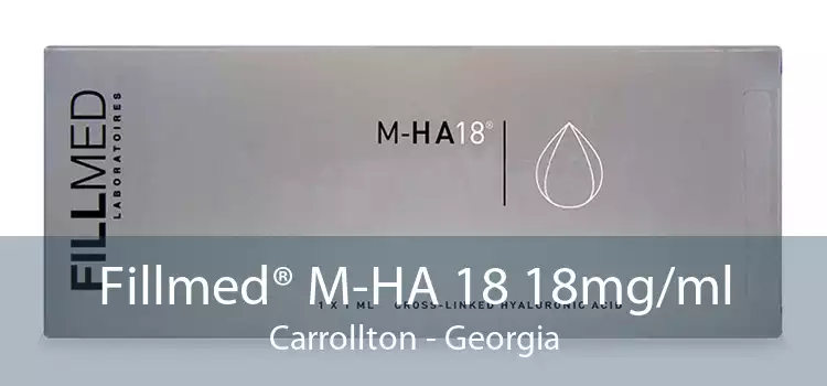 Fillmed® M-HA 18 18mg/ml Carrollton - Georgia