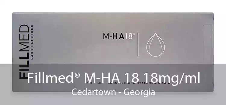 Fillmed® M-HA 18 18mg/ml Cedartown - Georgia