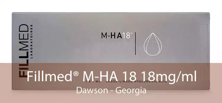 Fillmed® M-HA 18 18mg/ml Dawson - Georgia