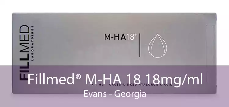 Fillmed® M-HA 18 18mg/ml Evans - Georgia