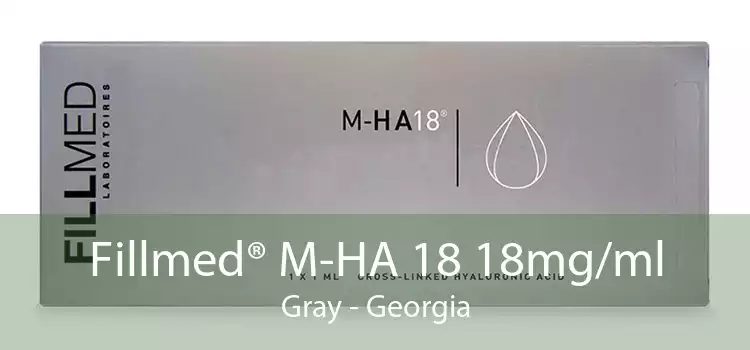 Fillmed® M-HA 18 18mg/ml Gray - Georgia