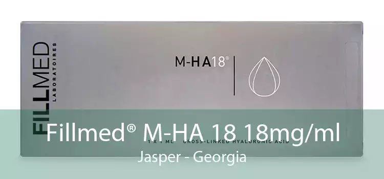 Fillmed® M-HA 18 18mg/ml Jasper - Georgia