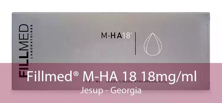 Fillmed® M-HA 18 18mg/ml Jesup - Georgia