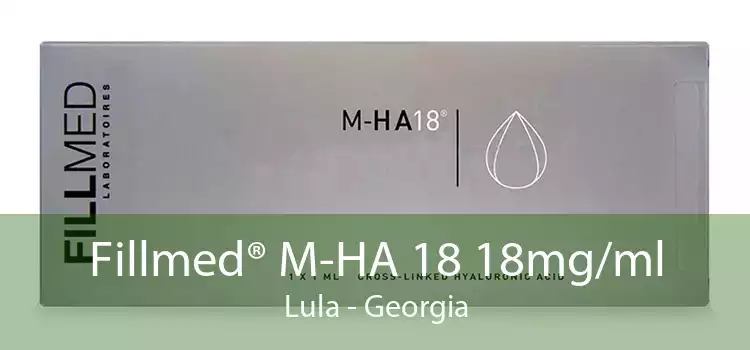 Fillmed® M-HA 18 18mg/ml Lula - Georgia