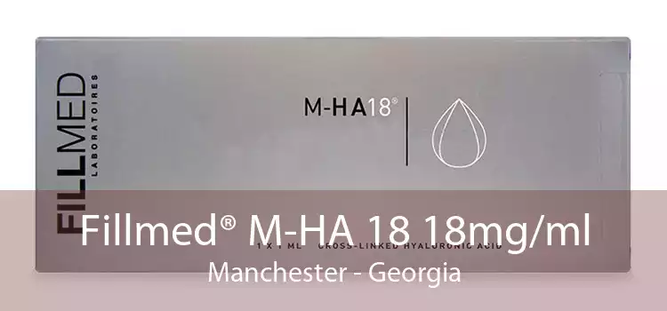 Fillmed® M-HA 18 18mg/ml Manchester - Georgia