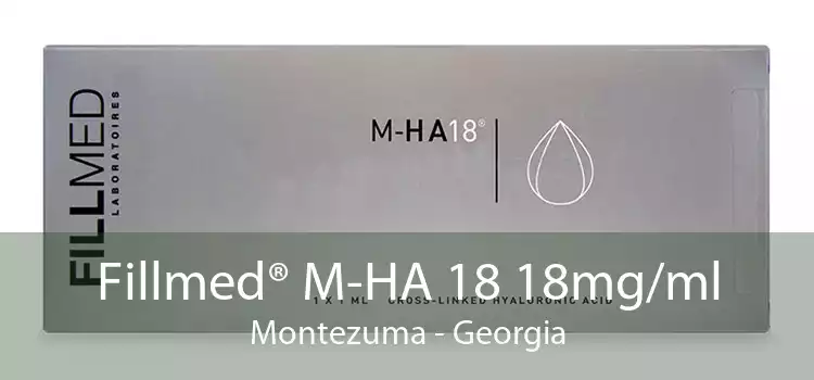 Fillmed® M-HA 18 18mg/ml Montezuma - Georgia