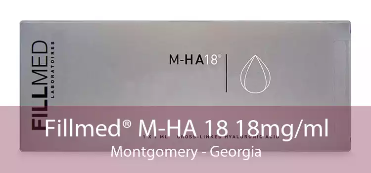 Fillmed® M-HA 18 18mg/ml Montgomery - Georgia