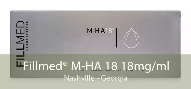 Fillmed® M-HA 18 18mg/ml Nashville - Georgia