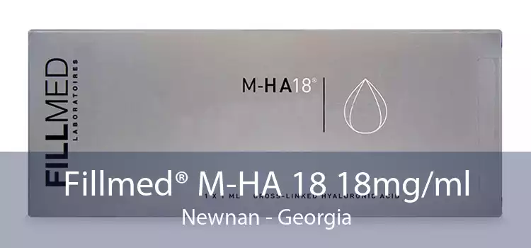 Fillmed® M-HA 18 18mg/ml Newnan - Georgia