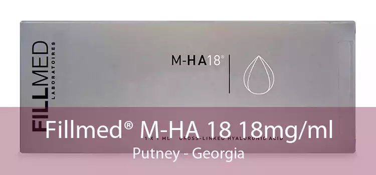 Fillmed® M-HA 18 18mg/ml Putney - Georgia