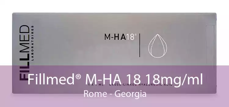 Fillmed® M-HA 18 18mg/ml Rome - Georgia