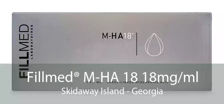 Fillmed® M-HA 18 18mg/ml Skidaway Island - Georgia