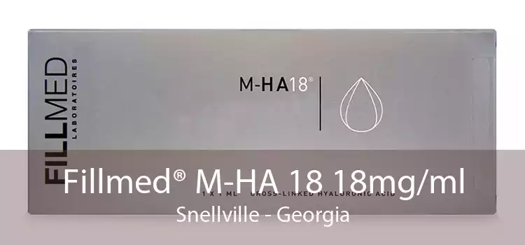 Fillmed® M-HA 18 18mg/ml Snellville - Georgia