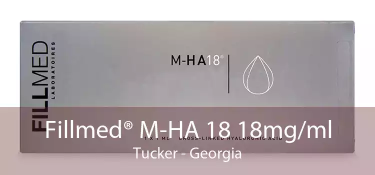 Fillmed® M-HA 18 18mg/ml Tucker - Georgia