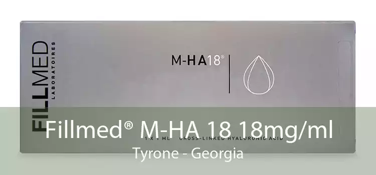 Fillmed® M-HA 18 18mg/ml Tyrone - Georgia