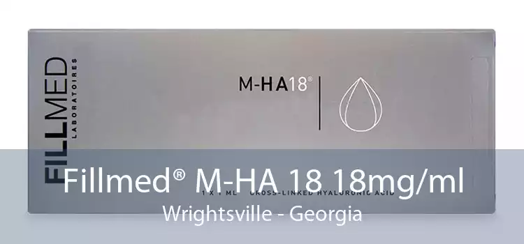 Fillmed® M-HA 18 18mg/ml Wrightsville - Georgia