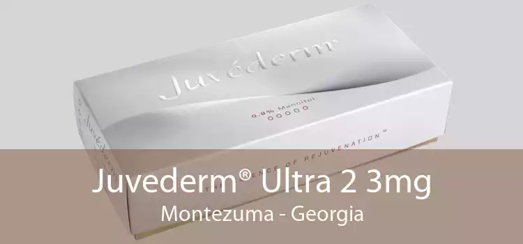 Juvederm® Ultra 2 3mg Montezuma - Georgia