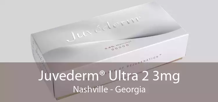 Juvederm® Ultra 2 3mg Nashville - Georgia