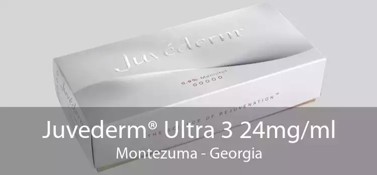 Juvederm® Ultra 3 24mg/ml Montezuma - Georgia