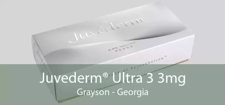 Juvederm® Ultra 3 3mg Grayson - Georgia