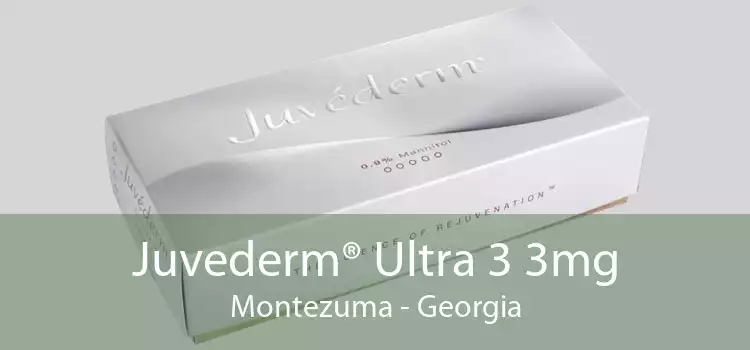 Juvederm® Ultra 3 3mg Montezuma - Georgia