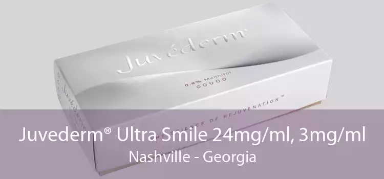 Juvederm® Ultra Smile 24mg/ml, 3mg/ml Nashville - Georgia