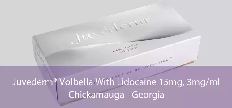 Juvederm® Volbella With Lidocaine 15mg, 3mg/ml Chickamauga - Georgia