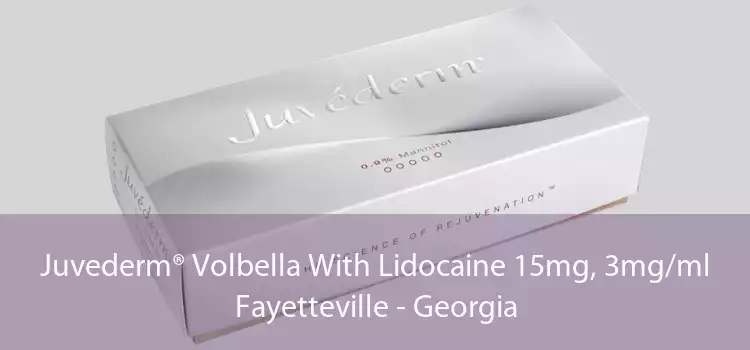 Juvederm® Volbella With Lidocaine 15mg, 3mg/ml Fayetteville - Georgia