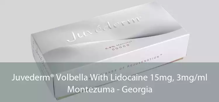 Juvederm® Volbella With Lidocaine 15mg, 3mg/ml Montezuma - Georgia
