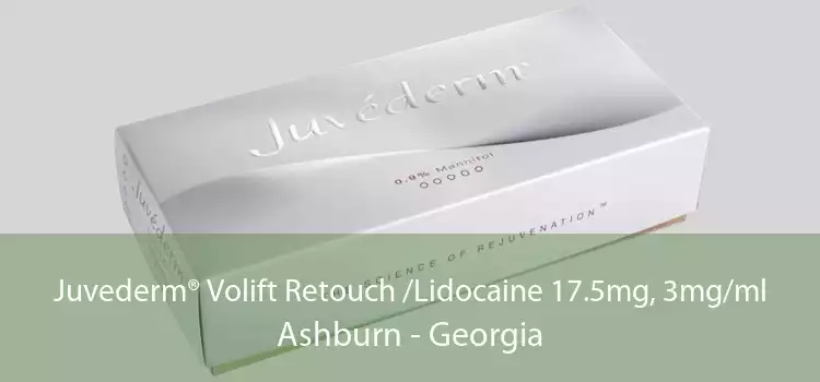 Juvederm® Volift Retouch /Lidocaine 17.5mg, 3mg/ml Ashburn - Georgia
