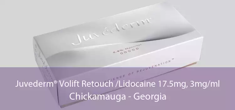 Juvederm® Volift Retouch /Lidocaine 17.5mg, 3mg/ml Chickamauga - Georgia