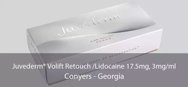Juvederm® Volift Retouch /Lidocaine 17.5mg, 3mg/ml Conyers - Georgia