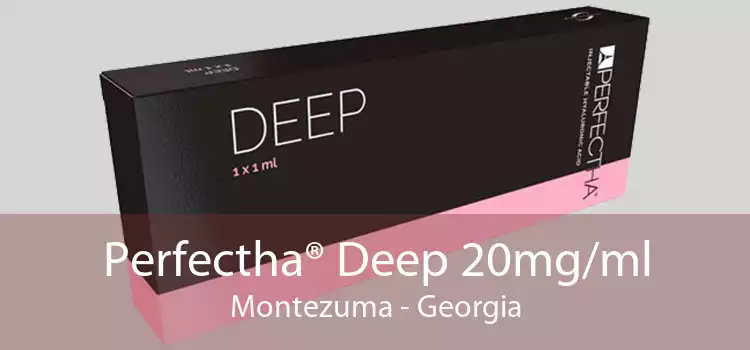 Perfectha® Deep 20mg/ml Montezuma - Georgia