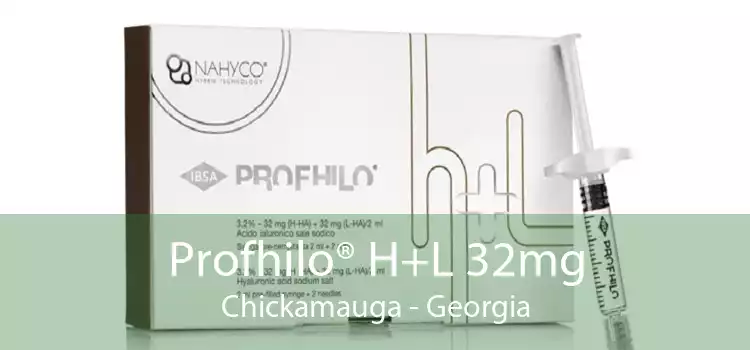 Profhilo® H+L 32mg Chickamauga - Georgia