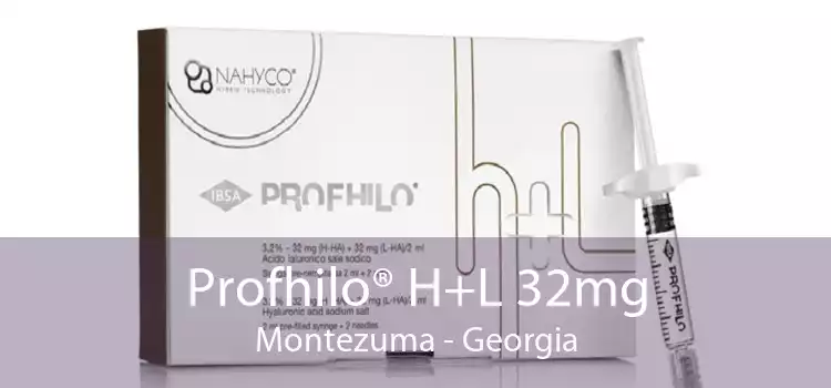 Profhilo® H+L 32mg Montezuma - Georgia