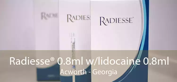 Radiesse® 0.8ml w/lidocaine 0.8ml Acworth - Georgia