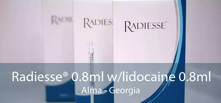 Radiesse® 0.8ml w/lidocaine 0.8ml Alma - Georgia