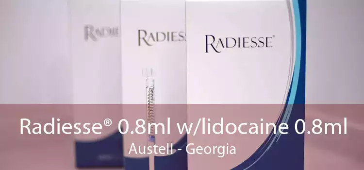 Radiesse® 0.8ml w/lidocaine 0.8ml Austell - Georgia
