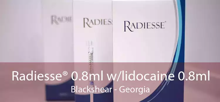 Radiesse® 0.8ml w/lidocaine 0.8ml Blackshear - Georgia