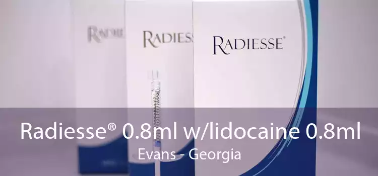 Radiesse® 0.8ml w/lidocaine 0.8ml Evans - Georgia