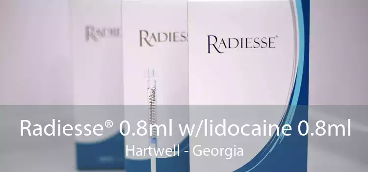 Radiesse® 0.8ml w/lidocaine 0.8ml Hartwell - Georgia