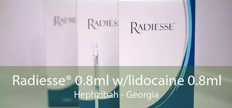 Radiesse® 0.8ml w/lidocaine 0.8ml Hephzibah - Georgia