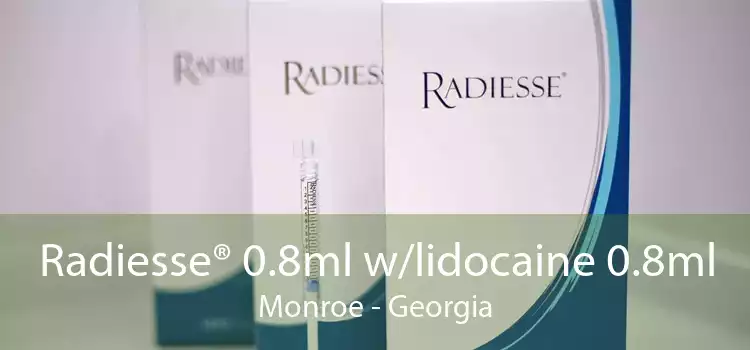 Radiesse® 0.8ml w/lidocaine 0.8ml Monroe - Georgia