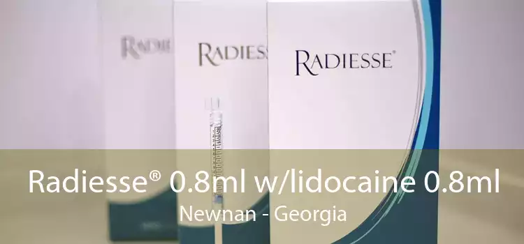 Radiesse® 0.8ml w/lidocaine 0.8ml Newnan - Georgia