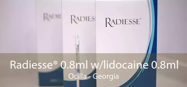 Radiesse® 0.8ml w/lidocaine 0.8ml Ocilla - Georgia