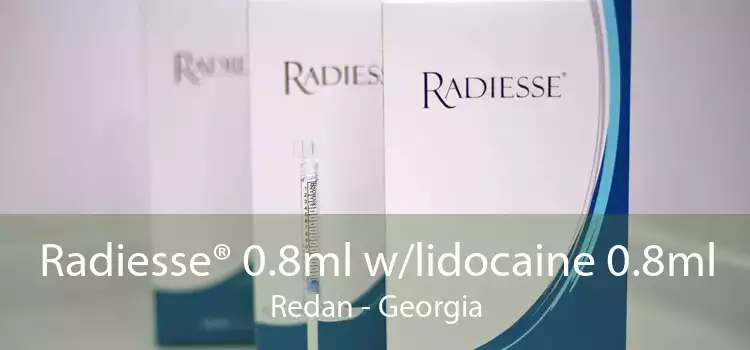 Radiesse® 0.8ml w/lidocaine 0.8ml Redan - Georgia